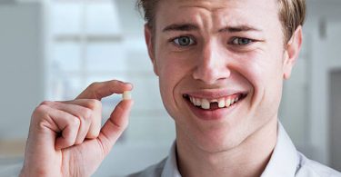 Options To Consider When You Have Missing Tooth