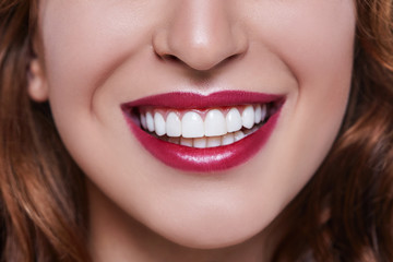 Reason why you should get your teeth whitened