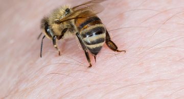 Home remedies for treating yellow jacket sting
