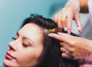  PRP Treatment For Hair Loss