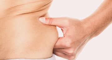 Weight Loss Coolsculpting