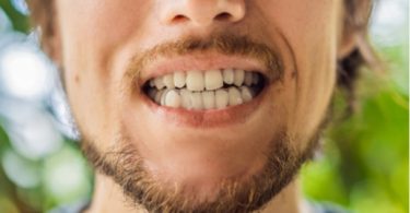 Teeth Grinding and Its Long-Term Effects