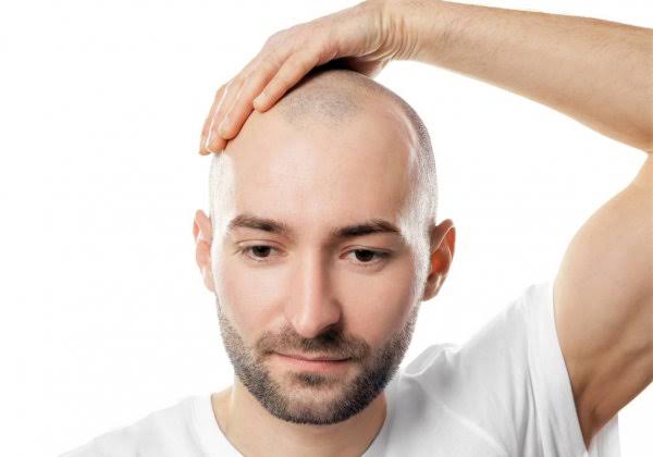 Hair Growth Tips For Male Pattern Baldness