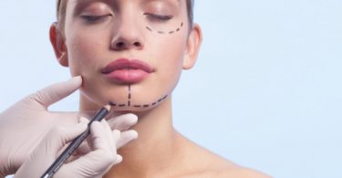 Getting Facial Plastic Surgery