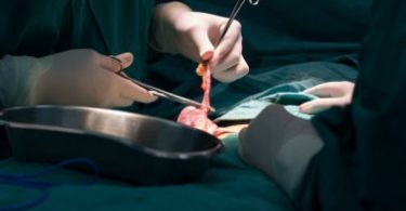consider before undergoing appendectomy