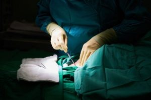 Adult Circumcision Surgery Manual