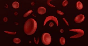 What is Sickle Cell Anemia?