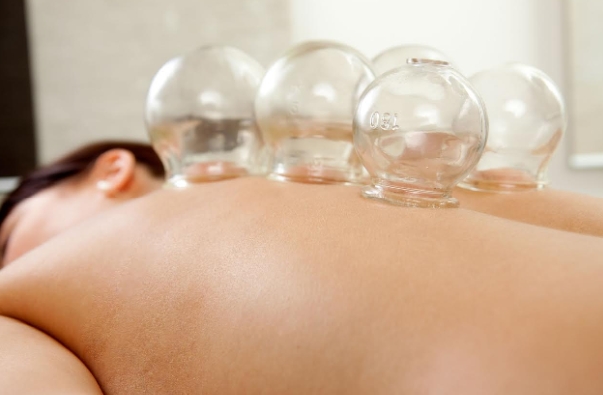 Benefits Of Cupping Therapy?