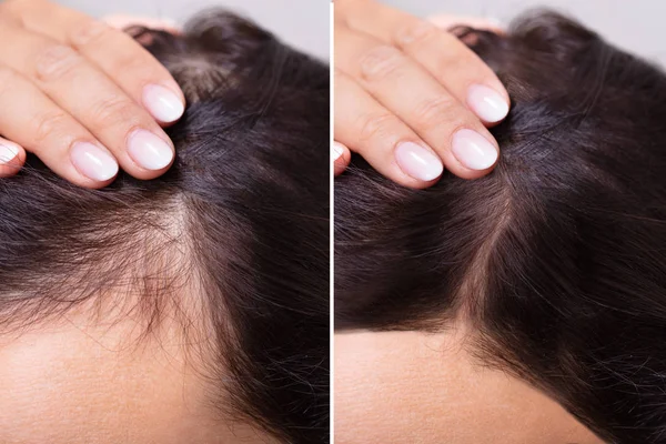 Does Provillus Hair Loss Treatment Really Work?