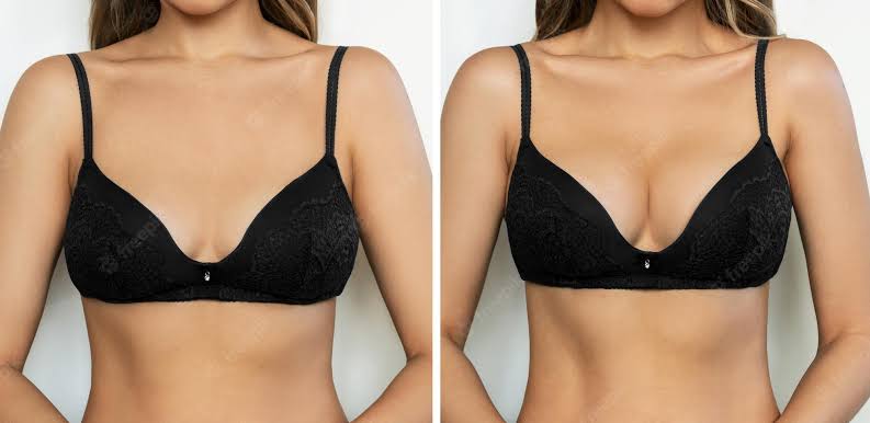 Does Breast Actives really work?
