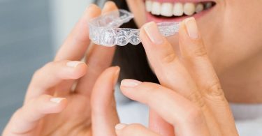 Dos & Don'ts of Cleaning Invisalign Aligners