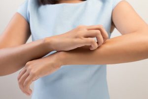 What Are The Three Types Of Eczema?
