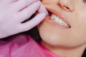 Common Causes Of Poor Dental Health