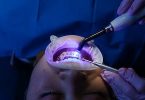 Innovative Dental Treatments for Tooth Decay: A Comprehensive Guide