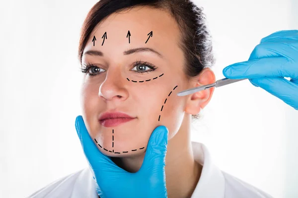 Overview of the Endoscopic Facelift Procedure