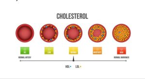 5 Lifestyle Changes to Help You Lower Your Cholesterol