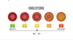 The 5 Lifestyle Changes That Will Help You Lower Your Cholesterol