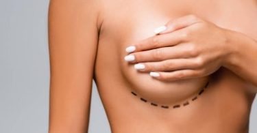 The Importance of Aftercare for Breast Plastic Surgery Patients