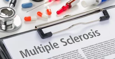 Recent Medical Breakthroughs in Multiple Sclerosis Care
